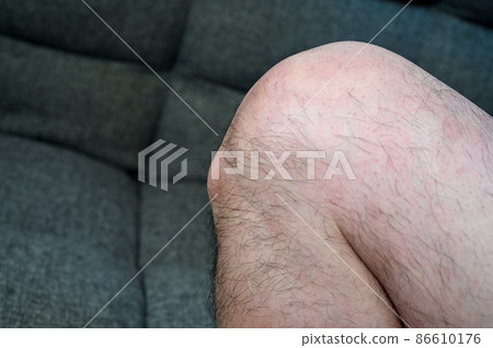 Osgood's disease Osgood-Schlatter's disease Growing pains knees and feet Osgood's disease Osgood-Schlatter's disease Growing pains knees and feet 86610176