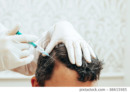Cosmetologist performs anti-aging procedures injections hyaluronic acid into scalp, hair growth prevention hair loss man 86615985