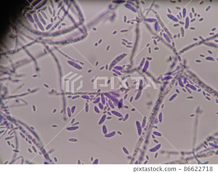 Fusarium where spores are scattered 86622718