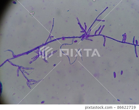 Where young hyphae grow 86622719