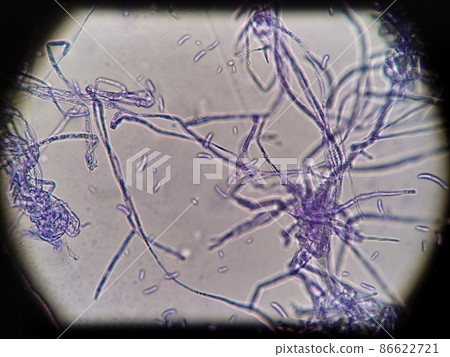 Moldy hyphae that spread like capillaries 86622721