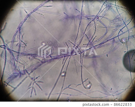 Young hyphae 86622833
