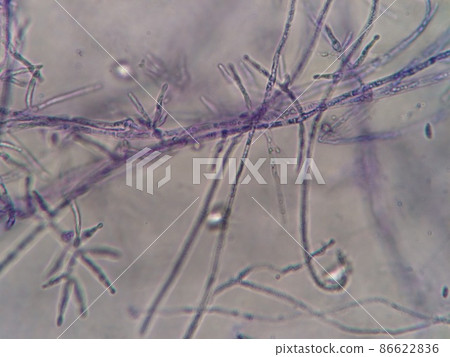 Fine hyphae Fine hyphae 86622836