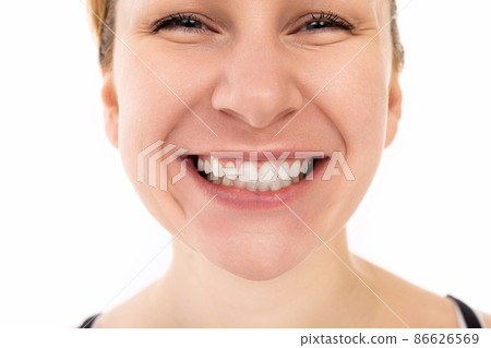 close-up portrait of a beautiful young middle-aged woman with a snow-white smile 86626569
