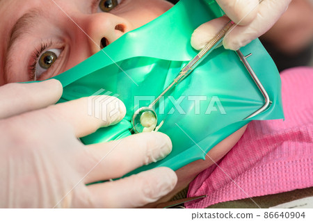 The dentist treats the child's tooth using a rubber dam. 86640904