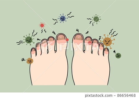 Unhealthy foot with nail infection or virus Unhealthy foot with nail infection or virus 86656468