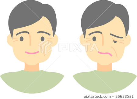 Signs of cerebral infarction, facial paralysis 86658581