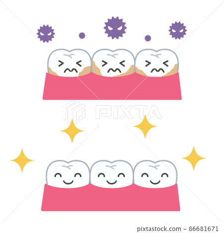 Caries healthy teeth - Stock Illustration [86681671] - PIXTA