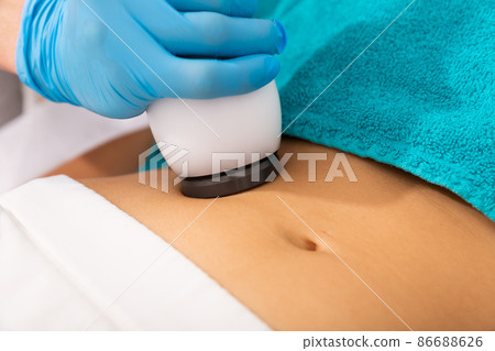 Woman receiving abdomen lifting procedure, close up 86688626