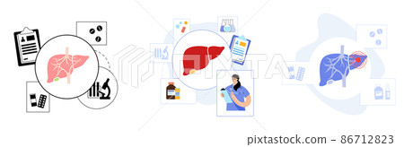 Liver disease concept 86712823