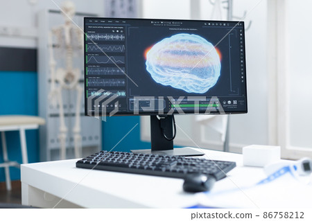 Computer with brain ct scan on screen standing on table in empty doctors office Computer with brain ct scan on screen standing on table in empty doctors office 86758212