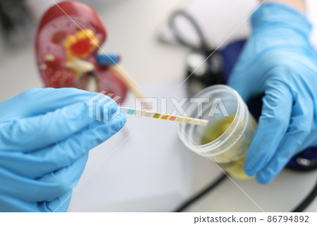 Doctor urologist making express urine test using indicator paper closeup Doctor urologist making express urine test using indicator paper closeup 86794892