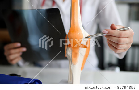 Doctor with xray in his hands showing structure of knee joint on artificial model closeup 86794895