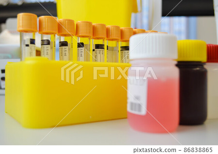 tubes in the holder next to liquid reagents for performing research. laboratory tests to detect diseases. venous blood tests under sterile conditions 86838865