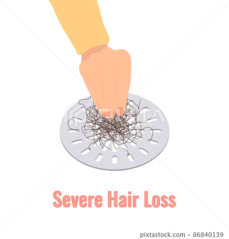 Shower drain clogged with clump of falling out hair 86840139