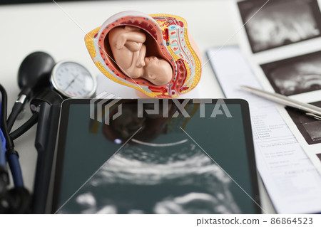 Model an uterus and a tablet with ultrasound on table Model an uterus and a tablet with ultrasound on table 86864523