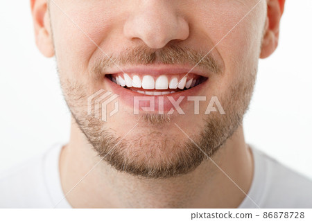 The smile of a young man in close-up. The result of teeth whitening. Beautiful smile with white healthy teeth. The smile of a young man in close-up. The result of teeth whitening. Beautiful smile with white healthy teeth. 86878728