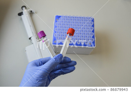 a doctor in a blue glove holds in his hand two test tubes for performing analyzes with multi-colored caps. against the background of a mechanical dispenser for performing analyzes. laboratory a doctor in a blue glove holds in his hand two test tubes for performing analyzes with multi-colored caps. against the background of a mechanical dispenser for performing analyzes. laboratory 86879943