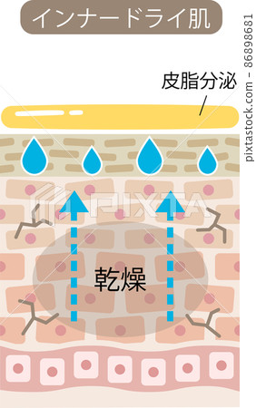 Inner dry skin cross section Inner dry skin cross section 86898681