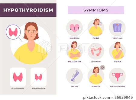 Hypothyroidism disease symptoms infographic with woman character. Underactive thyroid gland. Endocrine system health problem vector poster Hypothyroidism disease symptoms infographic with woman character. Underactive thyroid gland. Endocrine system health problem vector poster 86929949