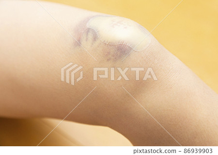 膠布貼在兒童腳上的划痕上 86939903