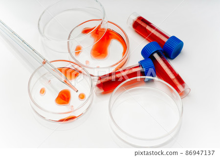 Medical laboratory. Blood coronavirus test.Virus vaccine development.COVID-19.Corona Virus in Lab. Test tube and Petri dish with blood samples on table in laboratory, closeup. Virus research.Close-up. 86947137