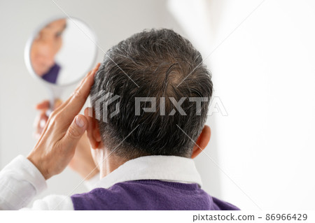 高級男性枕部頭髮護理 86966429