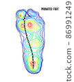 Pronated foot, arch deformation, bottom view. Foot weight distribution. 86991249