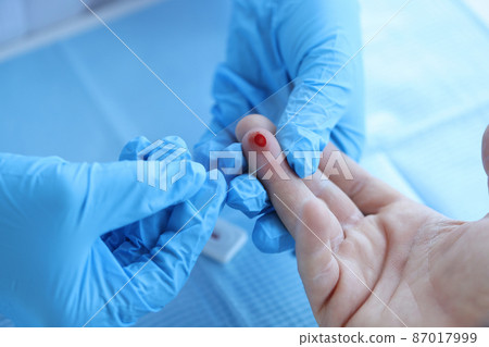 Doctor takes blood sample of patient serological test for PRP blood antibodies 87017999