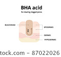 BHA acid for cleaning clogged pores. Removing blackheads, salicylic acid, oily skin. For topics like cosmetology, treatment, exfoliating 87022026