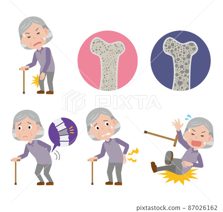 一位患有骨質疏鬆症的老年婦女的形象 87026162