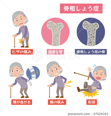 Image of an elderly woman with osteoporosis 87026163
