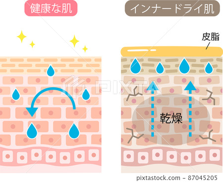 Inner Dry Skin Cells Before And After - Stock Illustration [87045205 