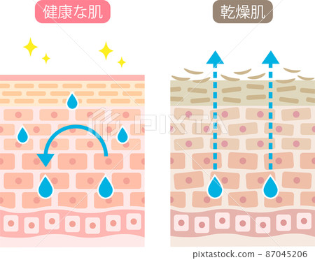 Cross section of dry skin before and after Cross section of dry skin before and after 87045206