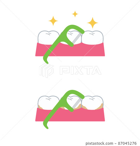 牙線和牙齒 87045276