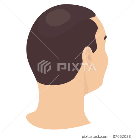 Head of a man in side view 87062028