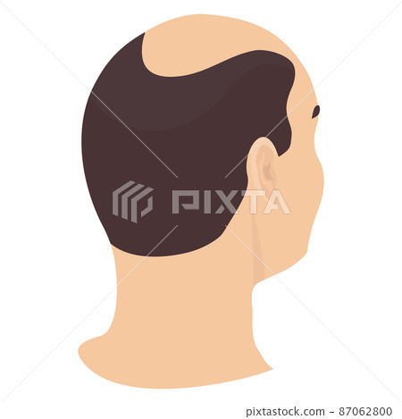 Head of a man in side view Head of a man in side view 87062800