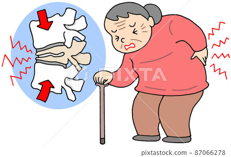 Vertebral compression fracture in the elderly Vertebral compression fracture in the elderly 87066278