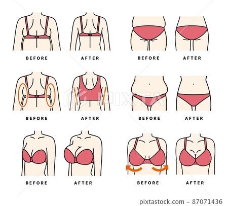 Diet bust-up makeup underwear set Diet bust-up makeup underwear set 87071436