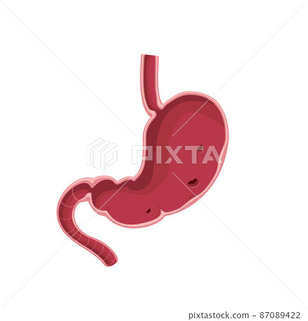 Stomach cross section, erosive gastritis 87089422