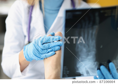 Female doctor examines x-ray of patient legs. Female doctor examines x-ray of patient legs. 87106664