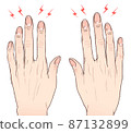 Rough fingertip hands 87132899