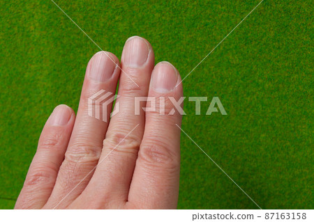 Hands, nails, skin, left hand, people, fingers, joints, body parts, parts, body parts, people 87163158