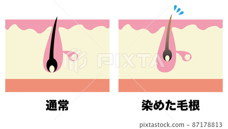 Pore image Pore image 87178813
