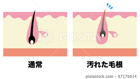 Pore image Pore image 87178814