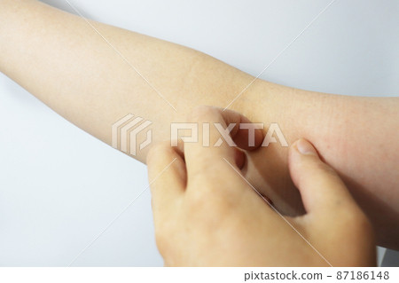 特應性皮炎 皮膚粗糙 87186148