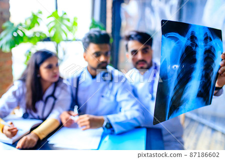 indian doctors are checking examining chest x-ray film indian doctors are checking examining chest x-ray film 87186602