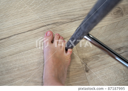 Woman hit furniture with the little toe. Incident at home. Injury of foot little finger 87187995