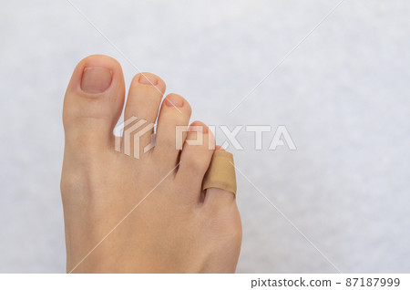 Medical plaster on the female little toe. Wound at toe healed with a band aid for medical care Medical plaster on the female little toe. Wound at toe healed with a band aid for medical care 87187999