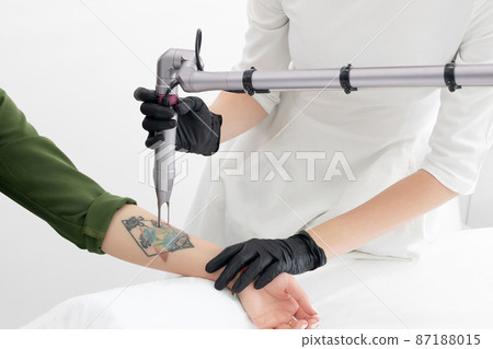 Beautician using laser device to remove an unwanted tattoo from female arm. Concept of erasing tattoos as an expensive procedure in a cosmetology clinic Beautician using laser device to remove an unwanted tattoo from female arm. Concept of erasing tattoos as an expensive procedure in a cosmetology clinic 87188015